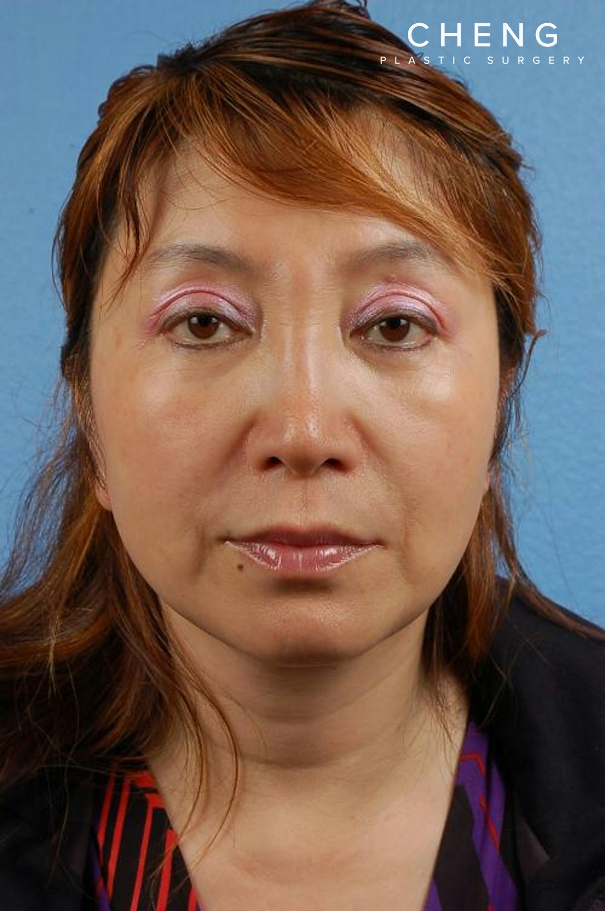 Hidden Patients Before & After Gallery - Patient 418792 - Image 2