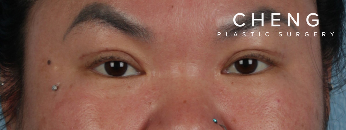 Hidden Patients Before & After Gallery - Patient 873403 - Image 2