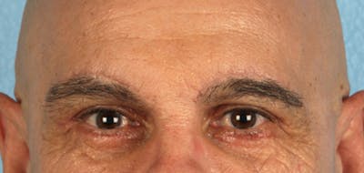 Hidden Patients Before & After Gallery - Patient 421996 - Image 2