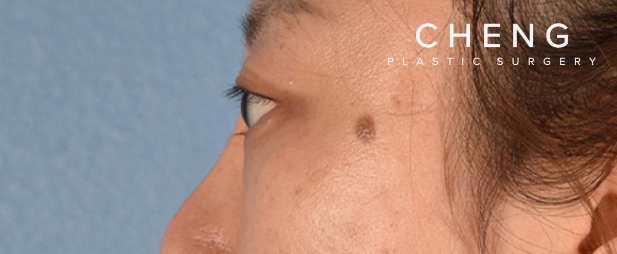 Hidden Patients Before & After Gallery - Patient 300838 - Image 8