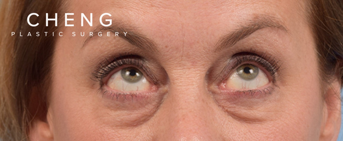 Hidden Patients Before & After Gallery - Patient 561726 - Image 3