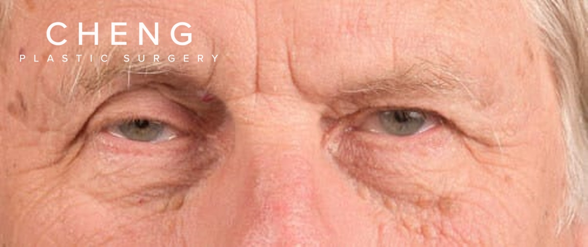 Hidden Patients Before & After Gallery - Patient 146304 - Image 1