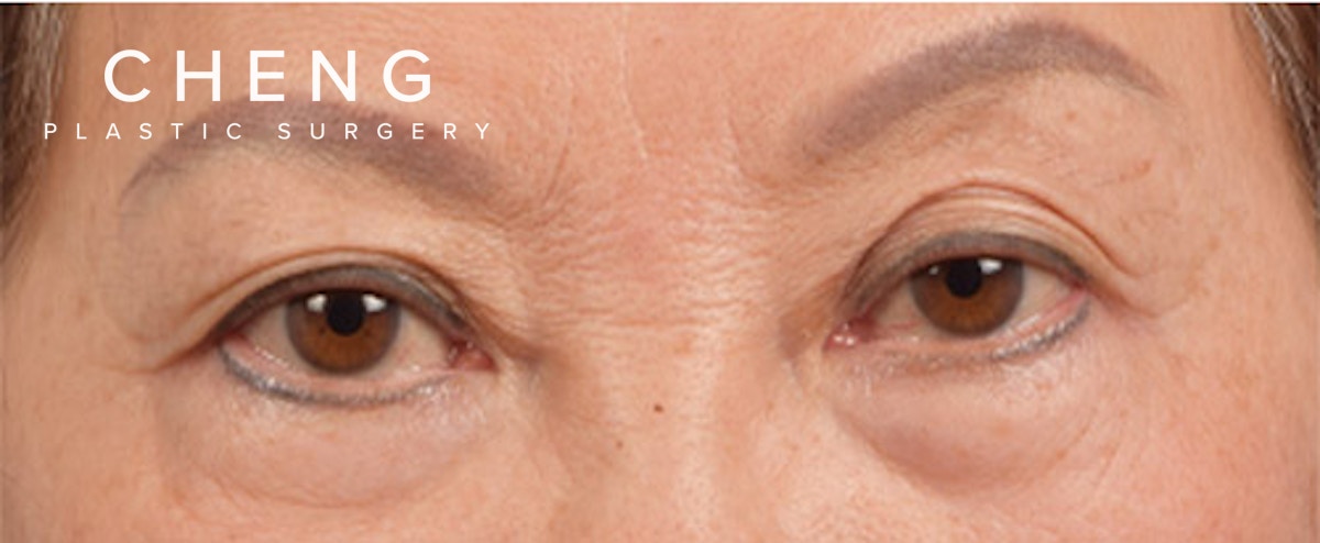 Hidden Patients Before & After Gallery - Patient 145659 - Image 1