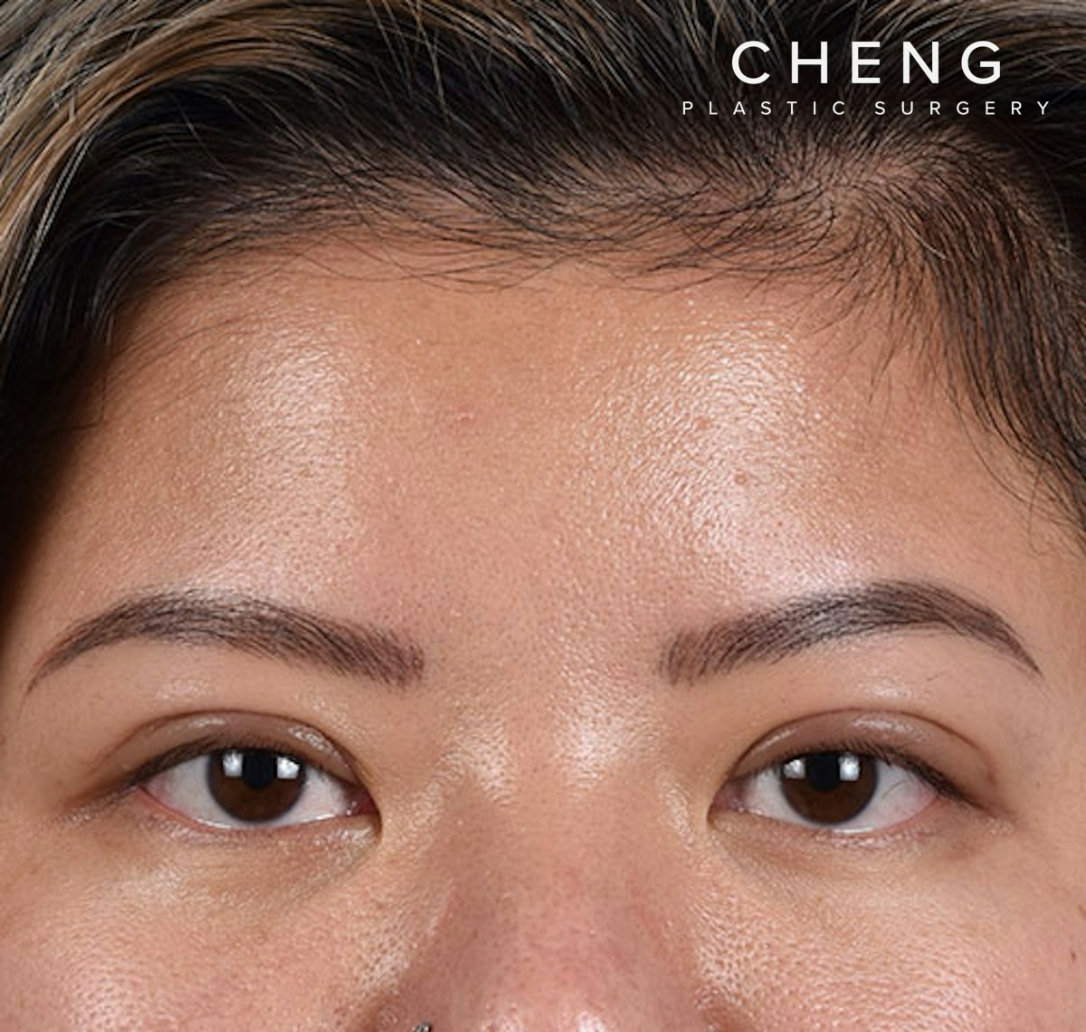Hidden Patients Before & After Gallery - Patient 392040 - Image 2
