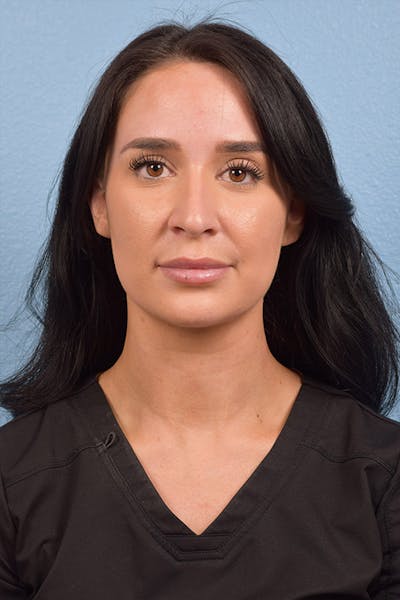 Hidden Patients Before & After Gallery - Patient 725234 - Image 1
