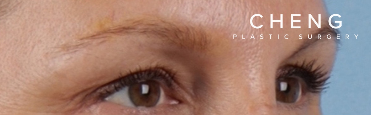 Hidden Patients Before & After Gallery - Patient 283134 - Image 4