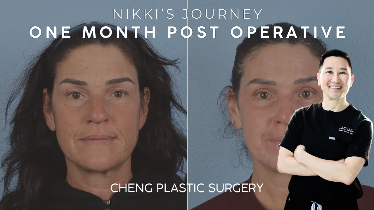Cheng Plastic Surgery