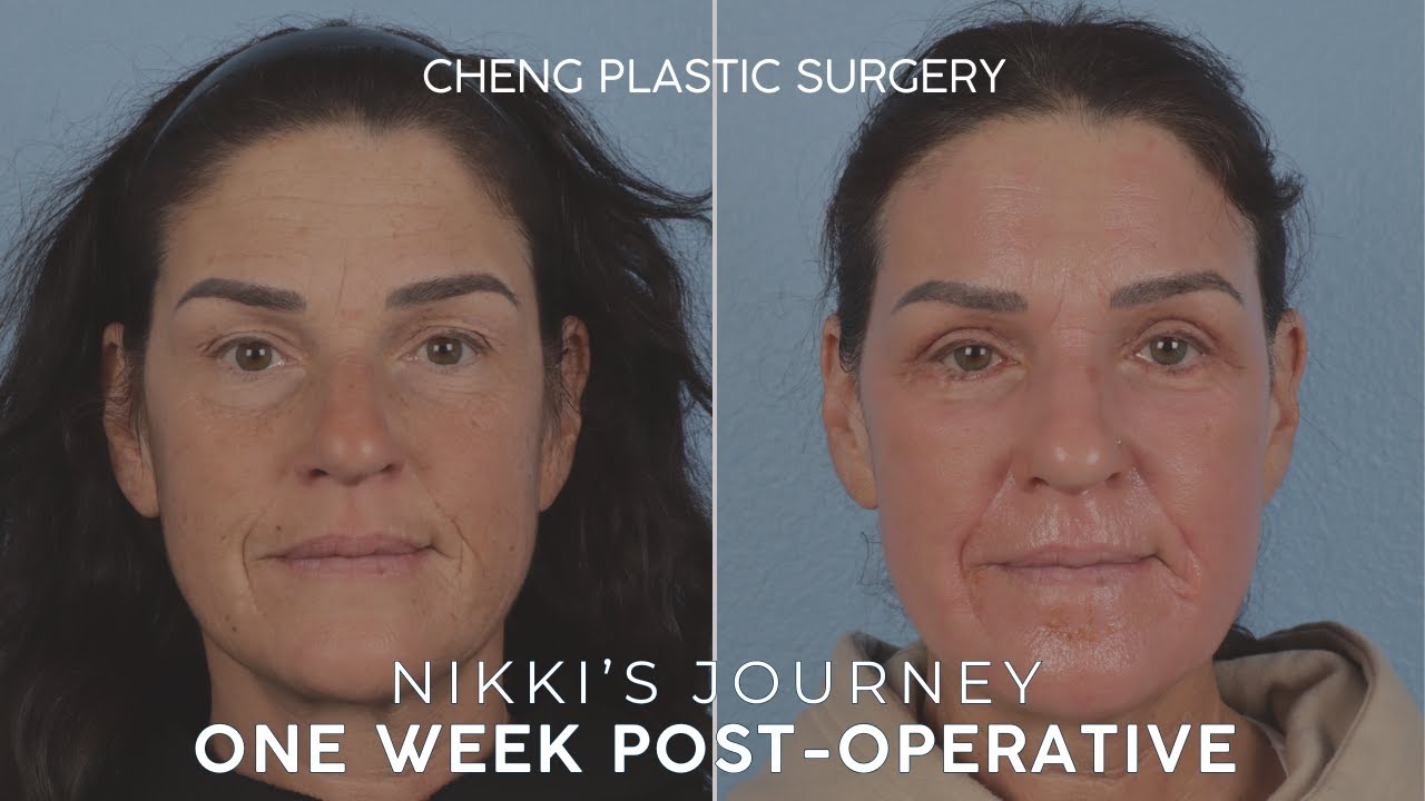 Cheng Plastic Surgery