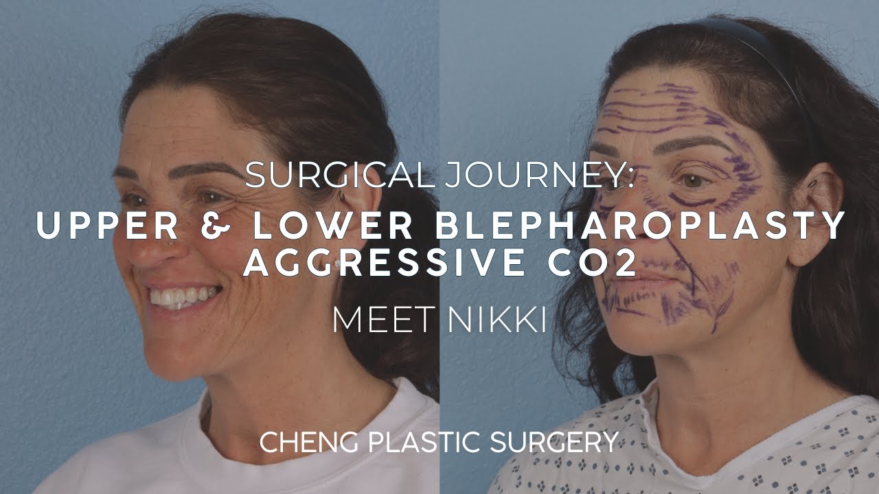 Cheng Plastic Surgery