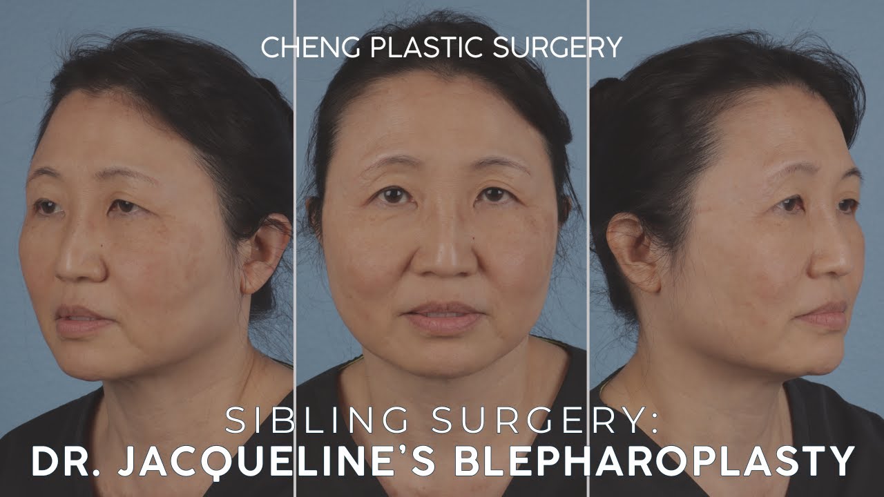 Cheng Plastic Surgery