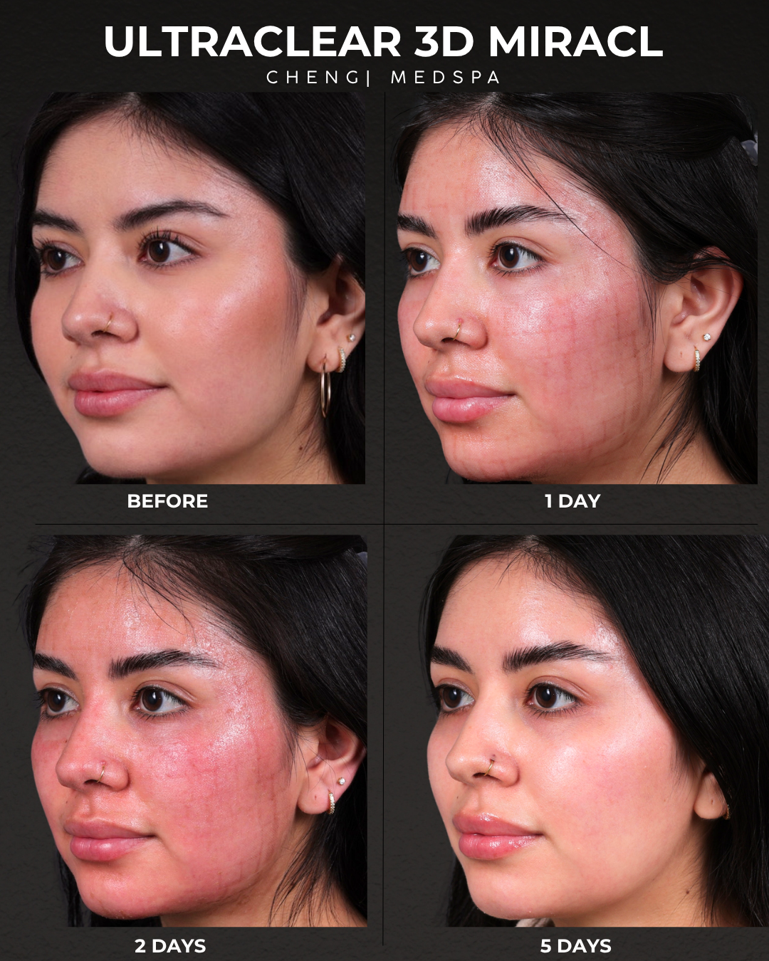 before and after